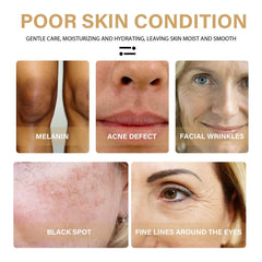 Revitalize Your Skin with EELHOE Turmeric Dark Spot Correction Serum
