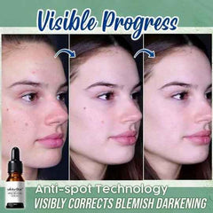 Transform Your Skin with Painless Spot Water Repair: Safe & Effective Solution
