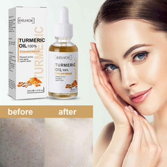 Revitalize Your Skin with EELHOE Turmeric Dark Spot Correction Serum