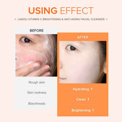 Laikou Vitamin C Cleanser: Revitalize Your Skin Effortlessly