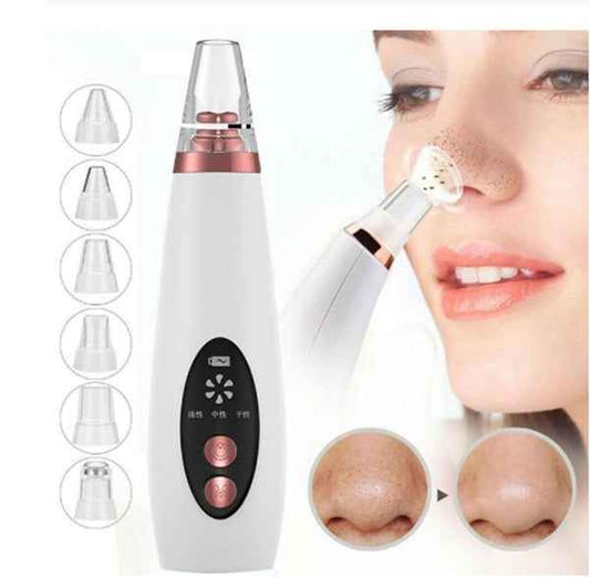 Blackhead Removal Device - Effortless Skin Cleansing at Home