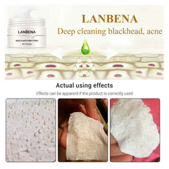 Gentle Blackhead Removal Treatment Mask - Snow Lotus Infused for Clear Skin