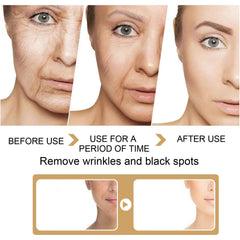Revitalize Your Skin with EELHOE Turmeric Dark Spot Correction Serum