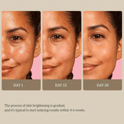 Turmeric Kojic Acid Glow Soap Dark Spot Acne Removal Even Skin Tone