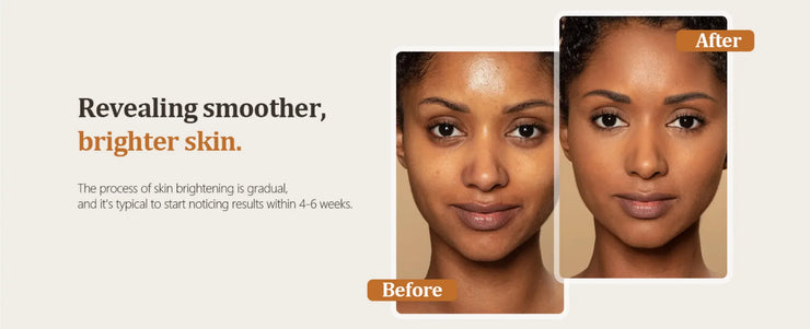 Turmeric Kojic Acid Glow Soap Dark Spot Acne Removal Even Skin Tone