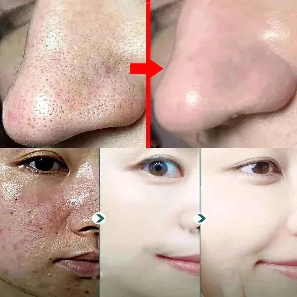 Green Tea Blackhead Removal Mask | Deep Pore Cleansing Stick Cream for Acne & Blemish Treatment
