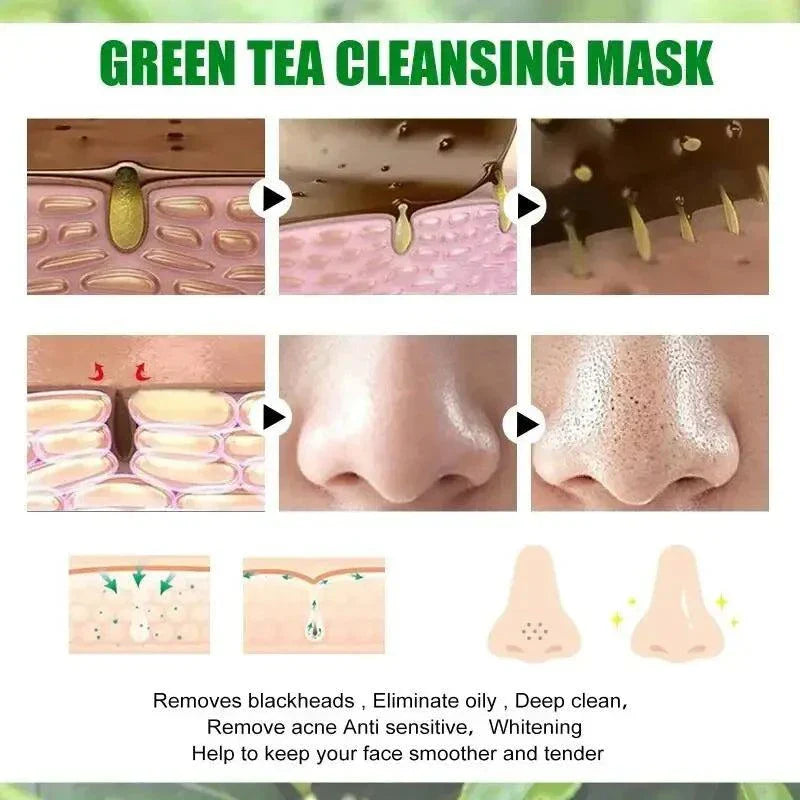 Green Tea Blackhead Removal Mask: Clear Skin Awaits You!