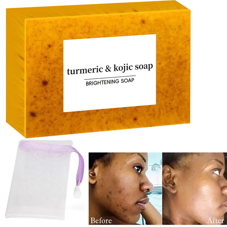Turmeric Kojic Acid Glow Soap Dark Spot Acne Removal Even Skin Tone