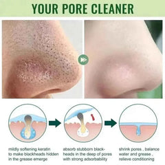 Green Tea Blackhead Removal Mask | Deep Pore Cleansing Stick Cream for Acne & Blemish Treatment