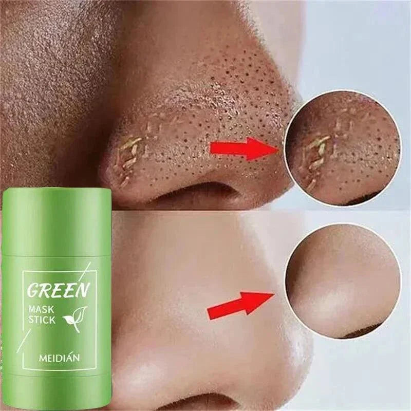 Green Tea Blackhead Removal Mask: Clear Skin Awaits You!