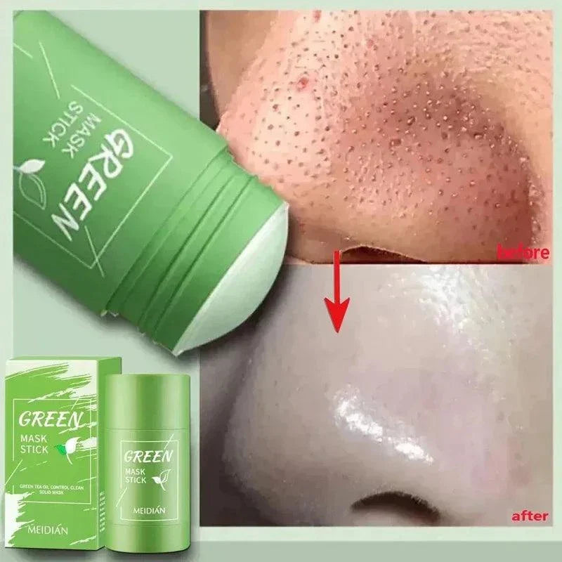 Green Tea Blackhead Removal Mask: Clear Skin Awaits You!