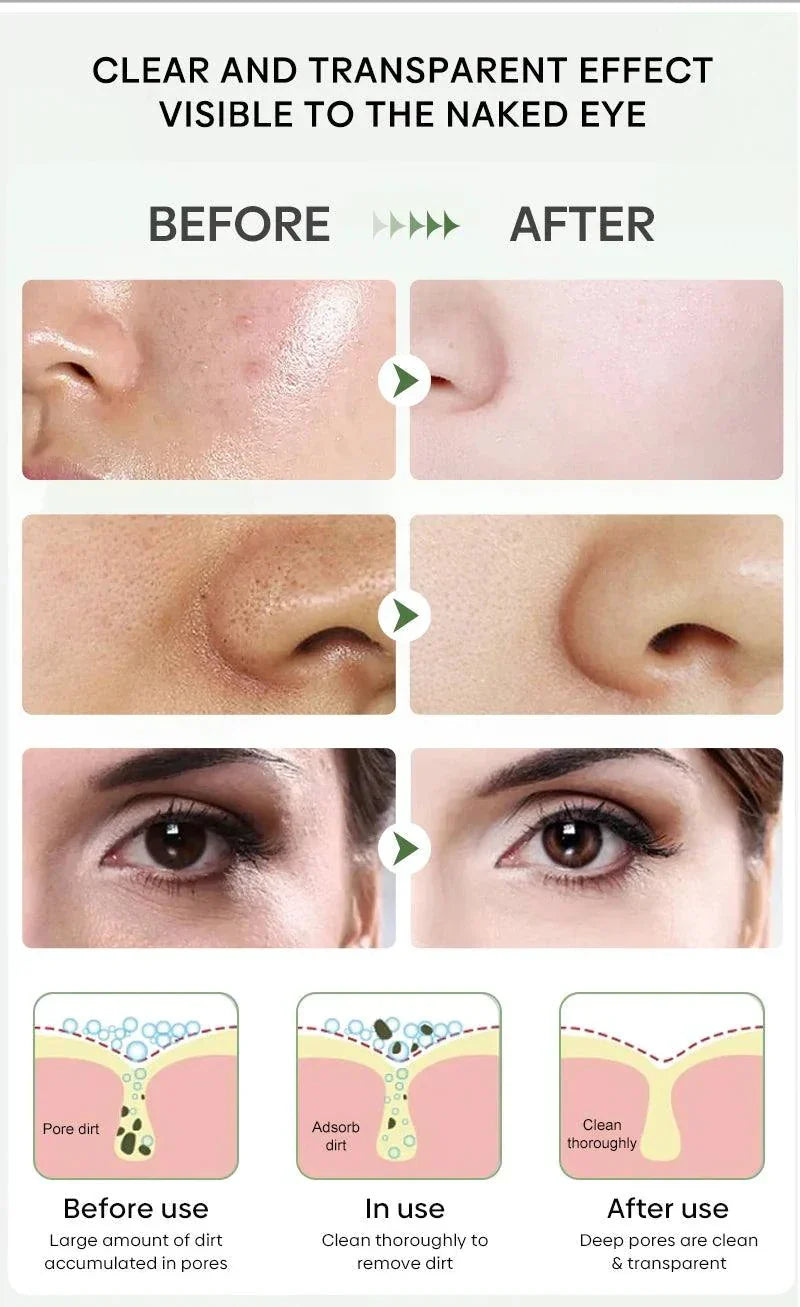 Green Tea Blackhead Removal Mask: Clear Skin Awaits You!