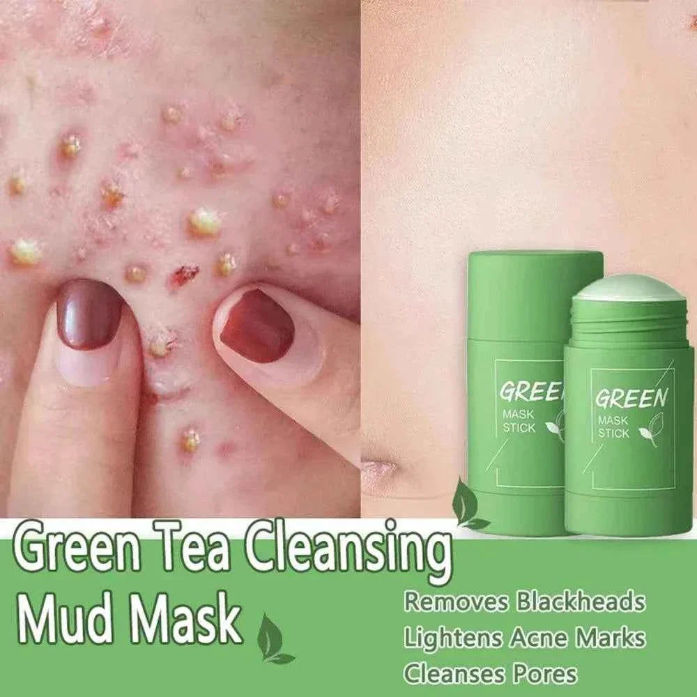 Green Tea Blackhead Removal Mask | Deep Pore Cleansing Stick Cream for Acne & Blemish Treatment