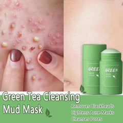 Green Tea Blackhead Removal Mask | Deep Pore Cleansing Stick Cream for Acne & Blemish Treatment